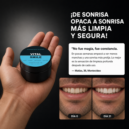 Carbon Activado VitalSmile